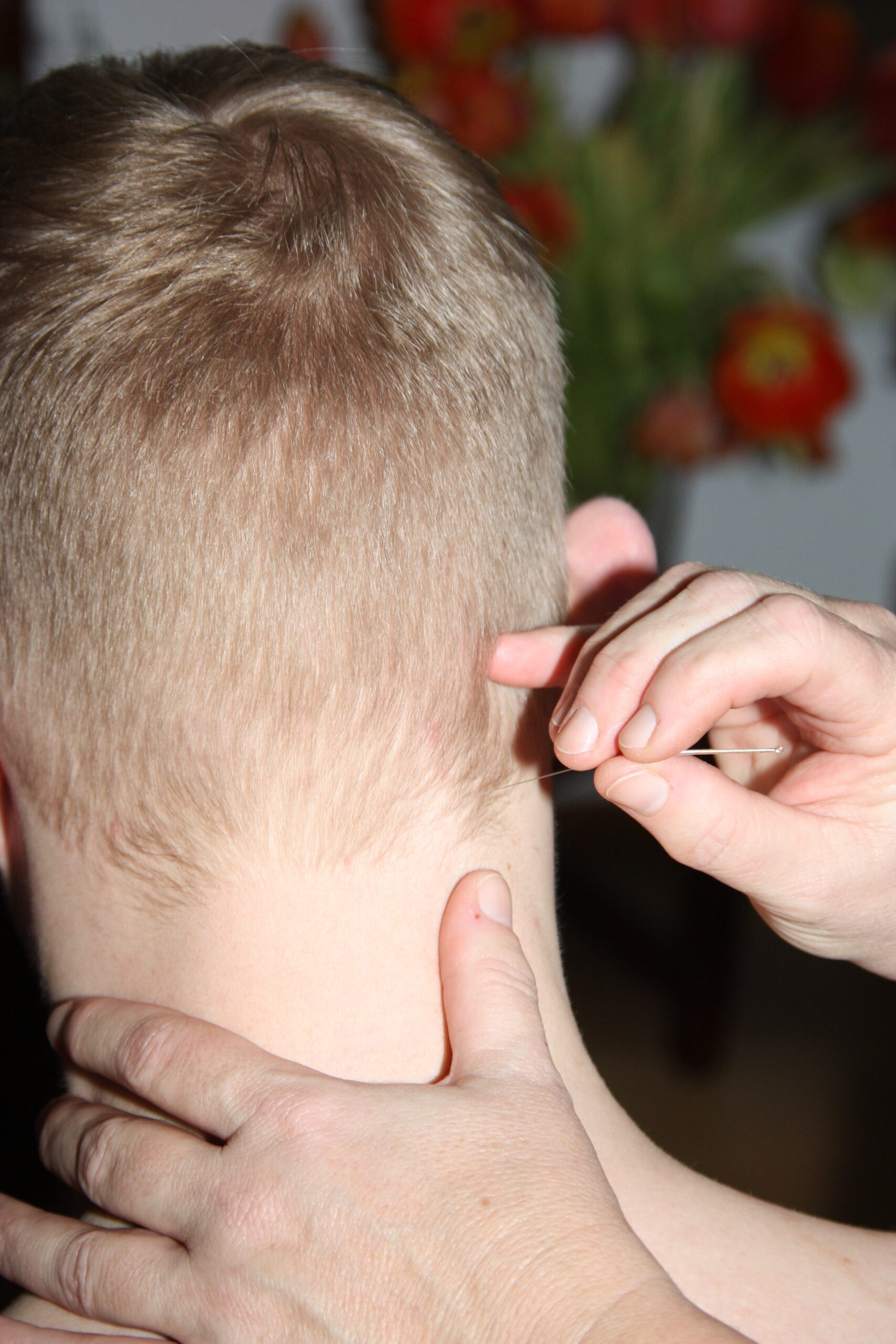 Chinesische Medizin bei Schmerzen…