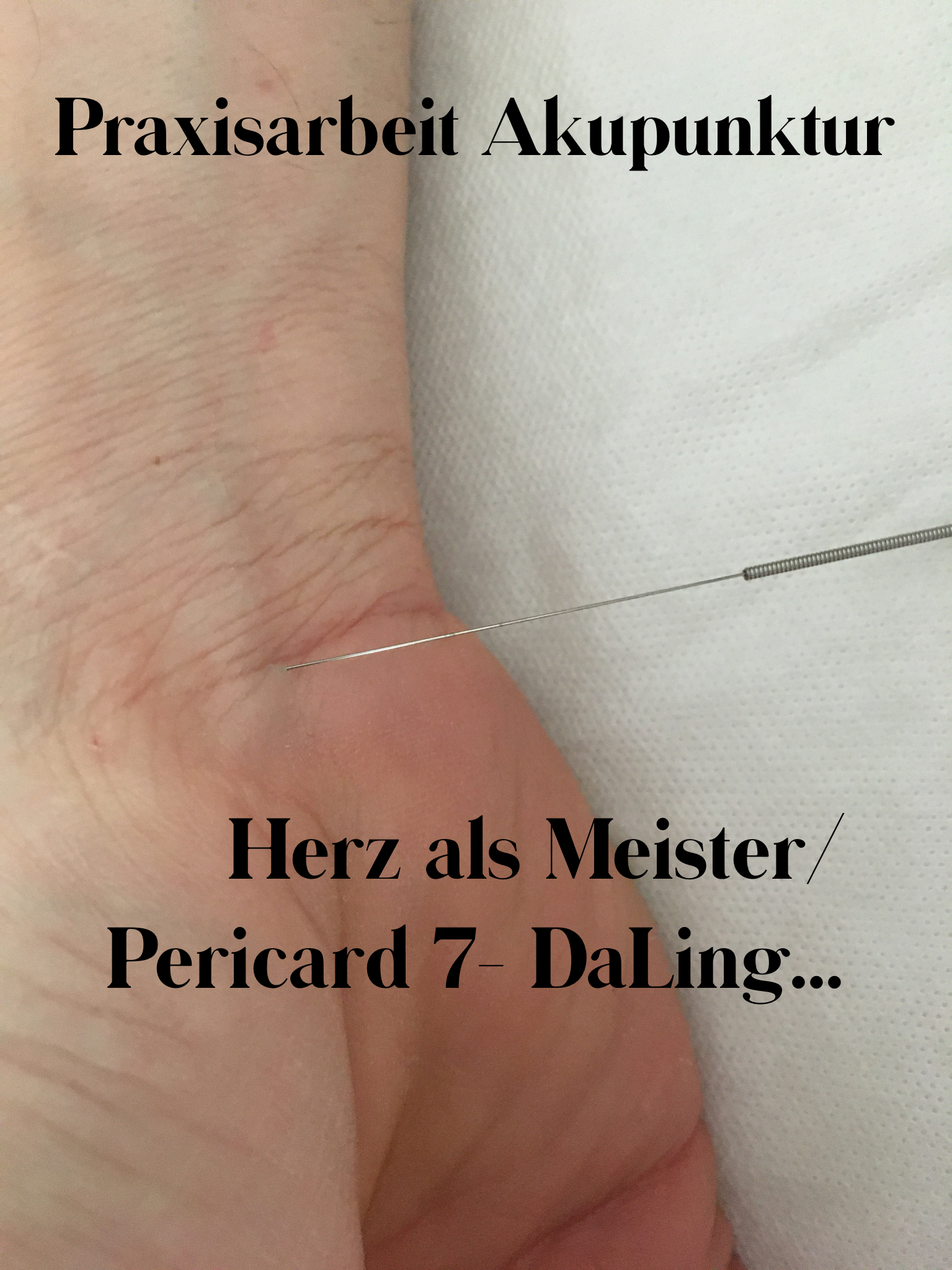Pericardmeridian…